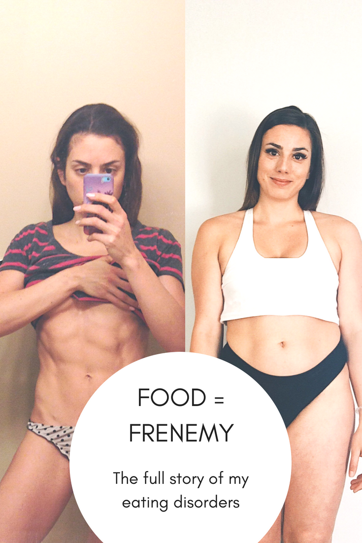 Food = frenemy The full story of my eating disorders