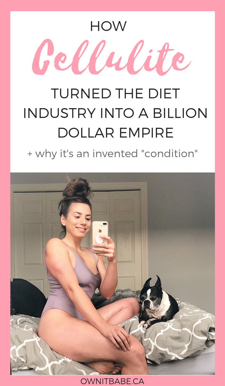 How cellulite became a "condition" that turned the diet industry into a billion dollar empire, by Rini Frey - ownitbabe.ca #cellulite #bodypositivity #bodyimage